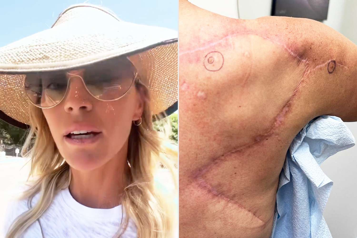 Edwin Arroyave Shares Teddi Mellencamp’s Recovery Journey After Brain Tumor Surgery