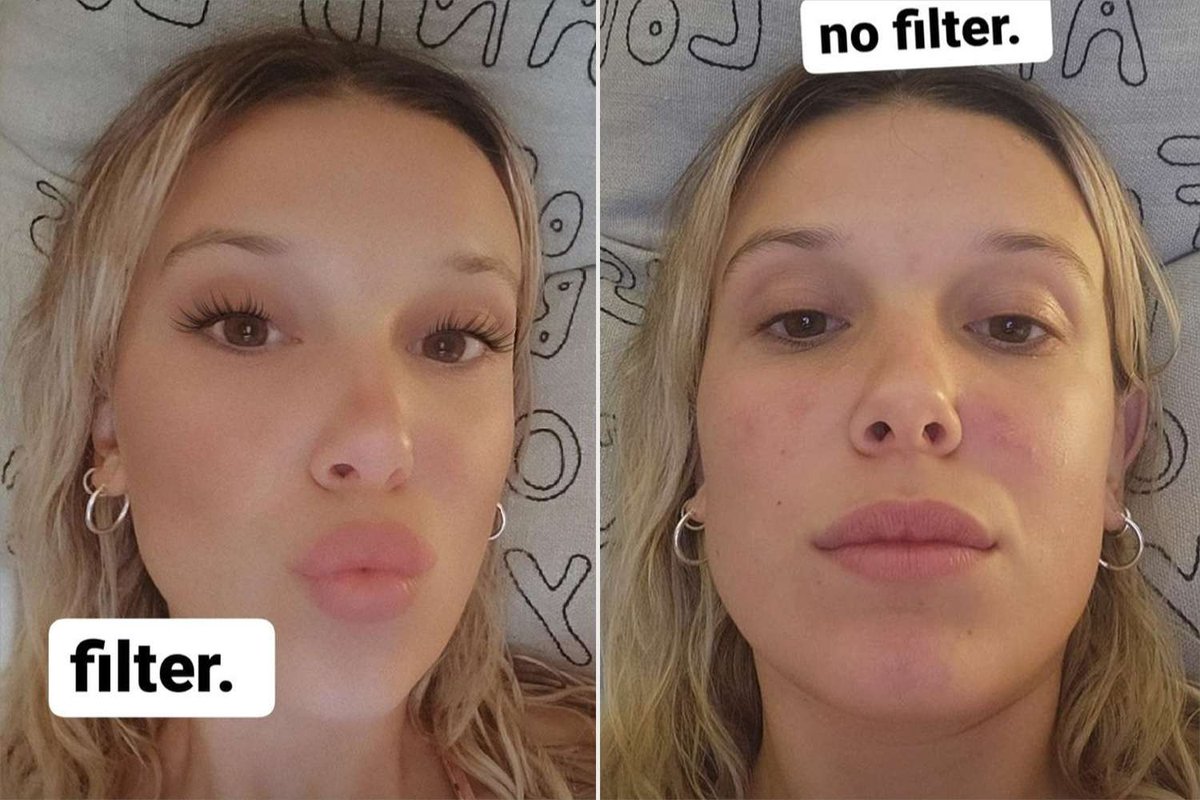 Millie Bobby Brown Ditches Makeup, Addresses Skin Struggles Amid Criticism