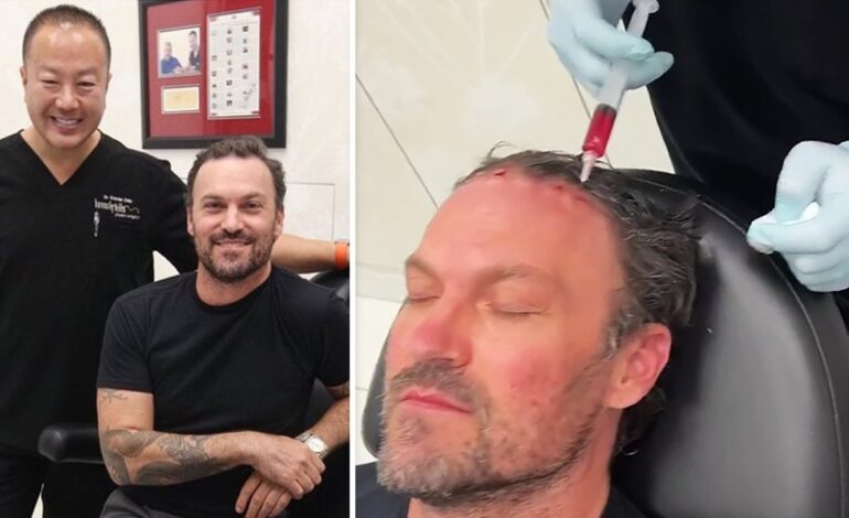 Brian Austin Green’s Appendix Surgery: Just Another Sign of Our Deteriorating Health