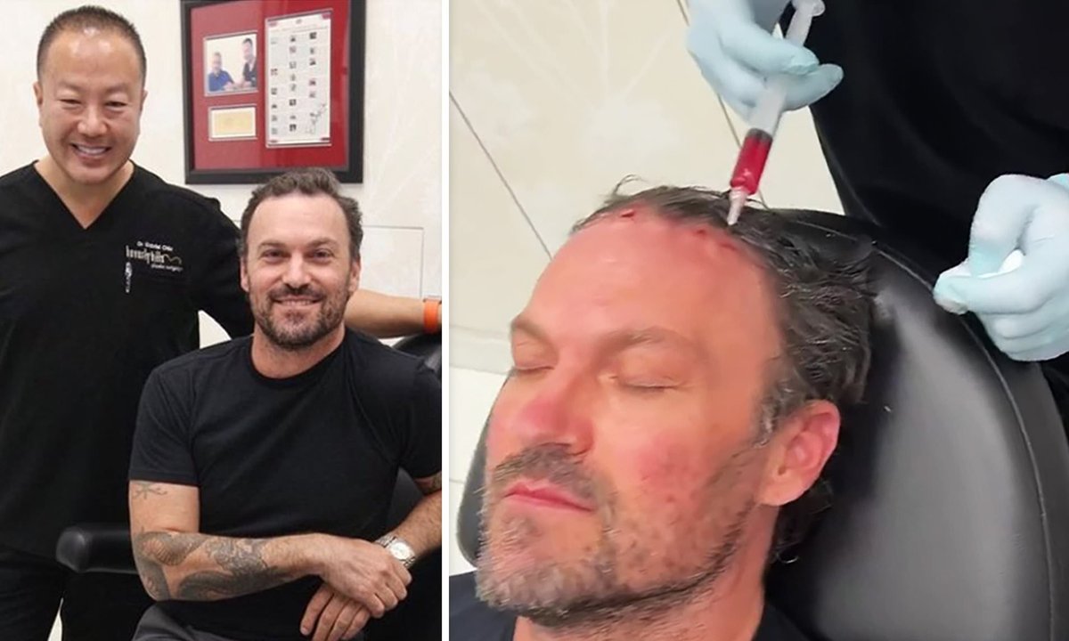 Brian Austin Green’s Appendix Surgery: Just Another Sign of Our Deteriorating Health