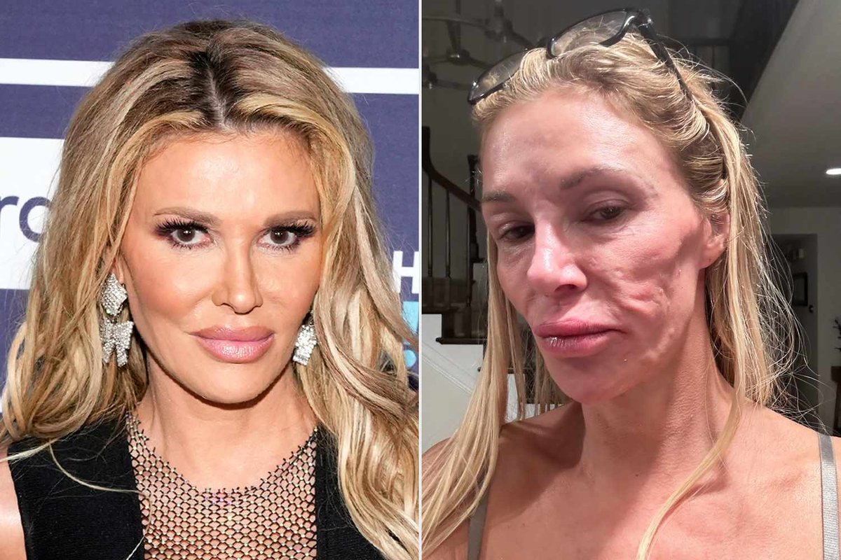 Celebrity Nightmare: Brandi Glanville’s Terrifying Morning Paralysis Revealed