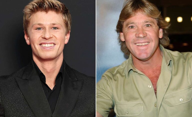 Dancing with Destiny: Robert Irwin’s Unexpected ‘DWTS’ Journey Fulfills Rylee Arnold’s Wildest Dream