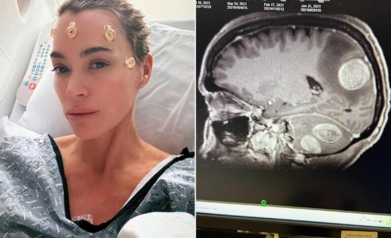 Hollywood Wellness Drama: Teddi Mellencamp’s Candid Health Reveal Alongside Kyle Richards
