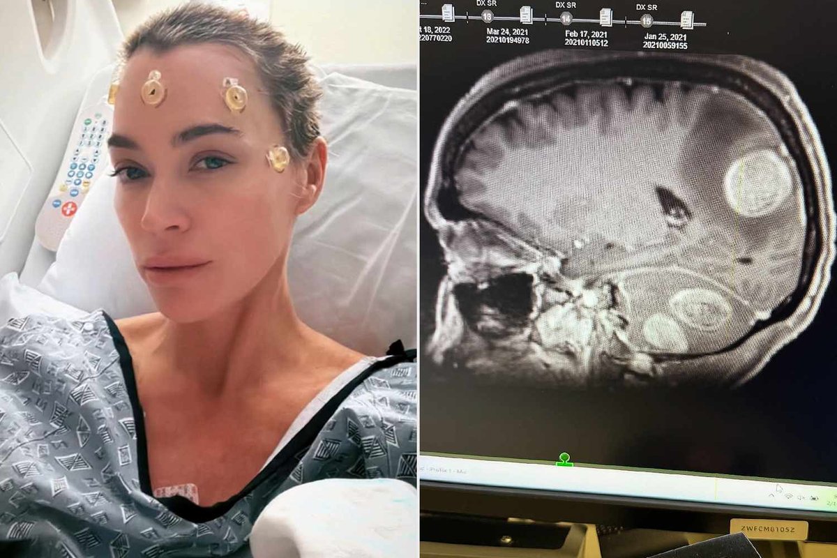 Hollywood Wellness Drama: Teddi Mellencamp’s Candid Health Reveal Alongside Kyle Richards