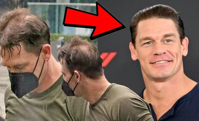 John Cena’s Bold Hair Transplant Reveal: What You Actually Need to Know