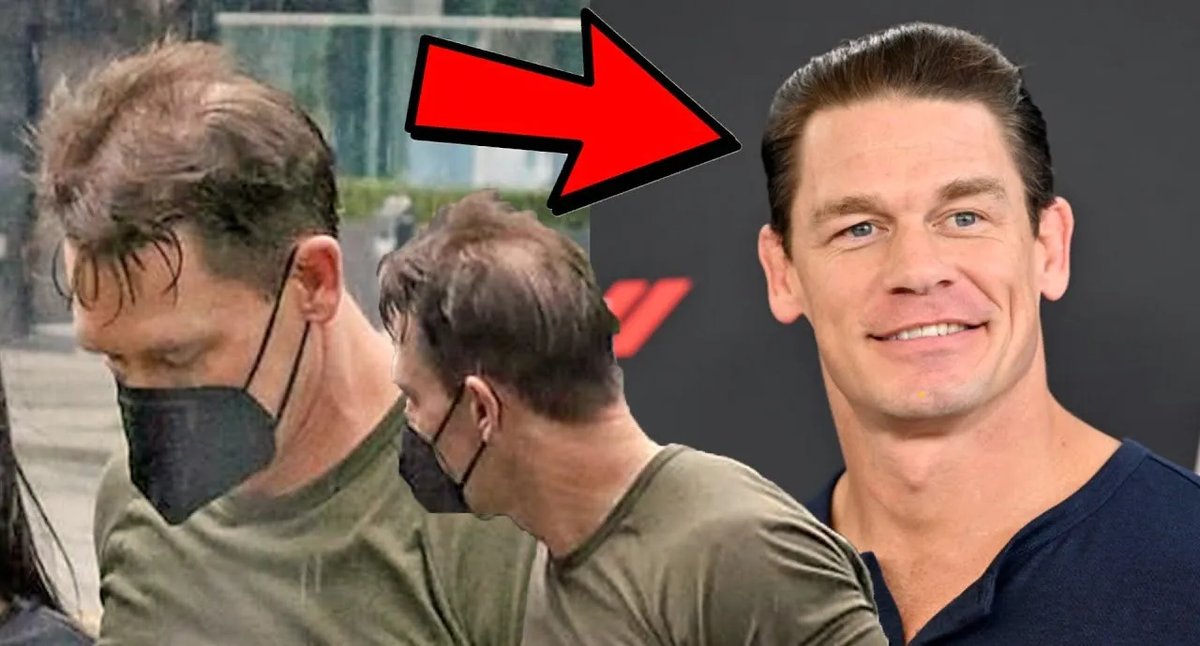 John Cena’s Bold Hair Transplant Reveal: What You Actually Need to Know