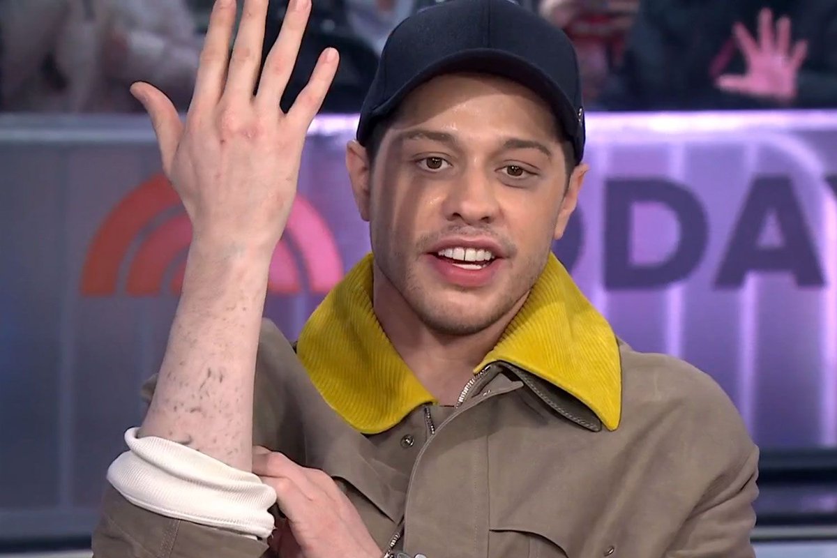 Pete Davidson Unpacks the Emotional Truth Behind His Ink: A Raw Journey of Healing and Self-Expression