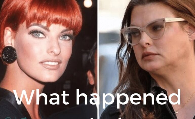 Supermodel’s Shocking Confession: Linda Evangelista’s Mirror Moment Reveals Painful Beauty Treatment Aftermath