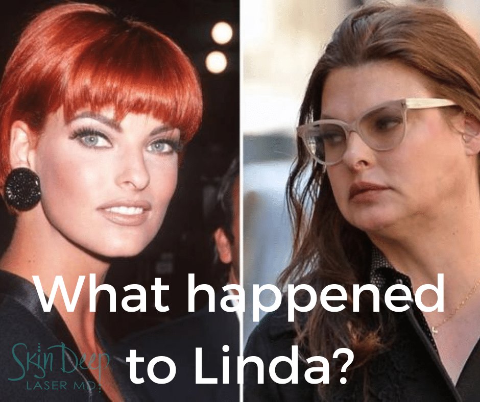 Supermodel’s Shocking Confession: Linda Evangelista’s Mirror Moment Reveals Painful Beauty Treatment Aftermath