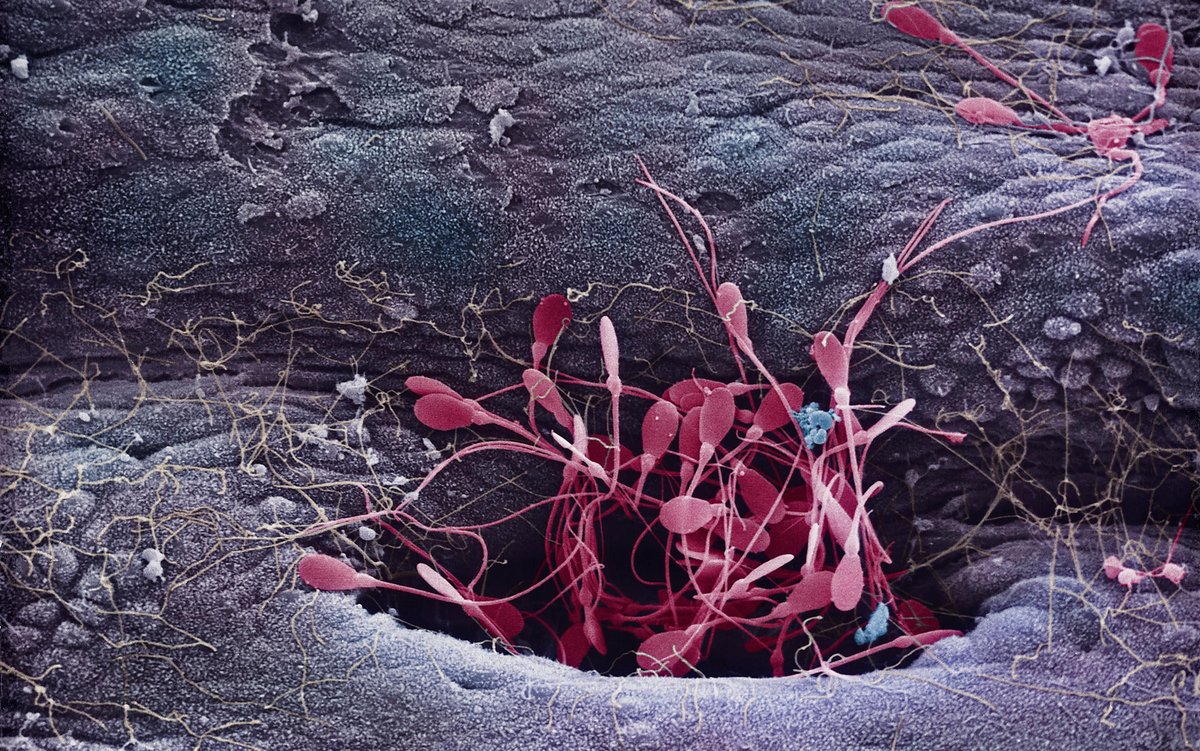 Unprecedented Reproductive Science Showdown: Inside the World’s First Sperm Competitive Racing Event