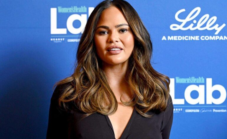 Chrissy Teigen Reveals Hairline Lowering Procedure After Viral Hospital Photo