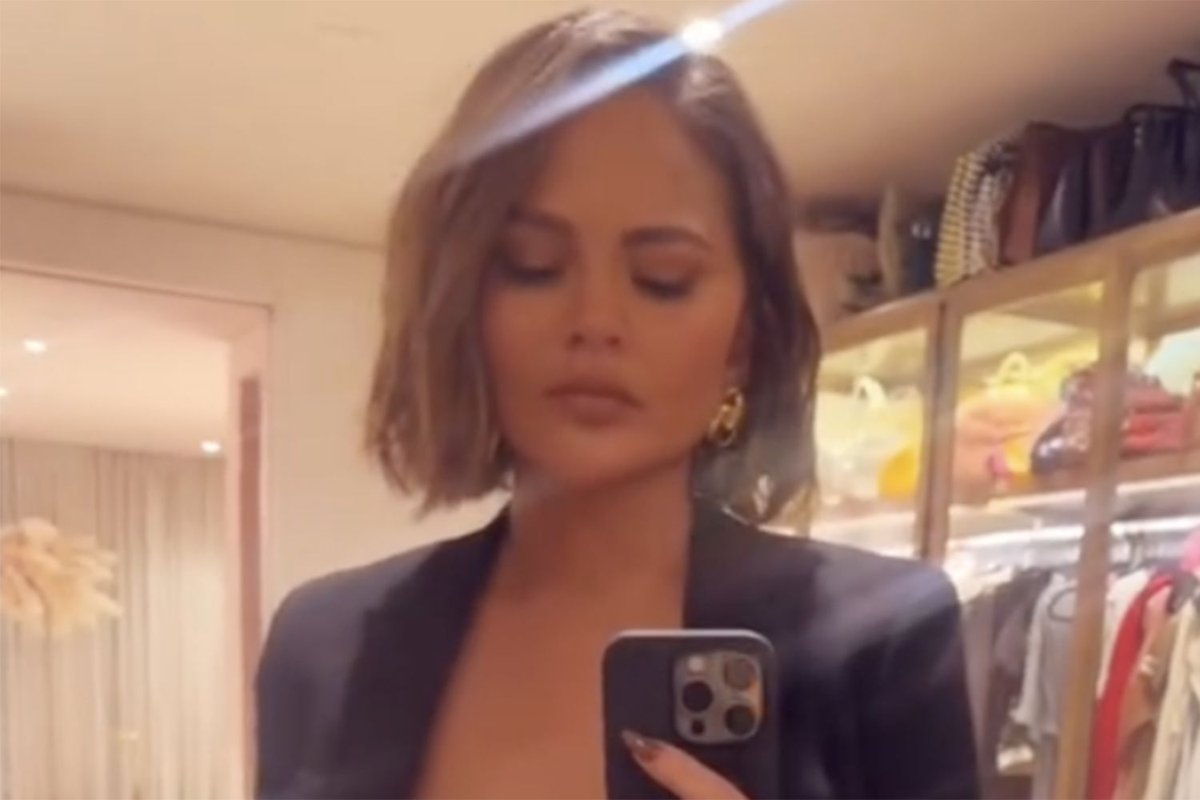Chrissy Teigen’s Bandaged Hairline Fix Explained