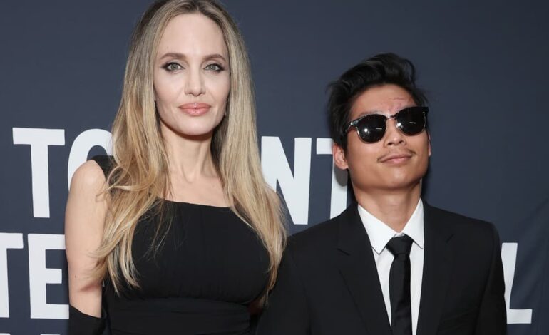 Fans Vote on Celebrity Scars: Top Stars Embrace Imperfections