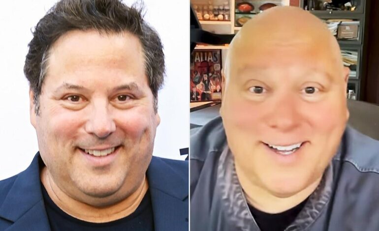 Greg Grunberg Reveals Why He Went Bald—The Heartfelt Truth