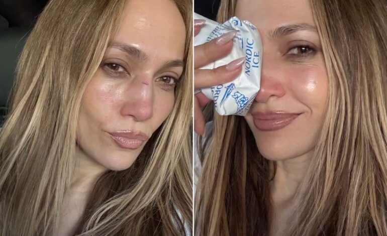 Jennifer Lopez Rehearsal Injury Sparks Empowering AMAs Comeback