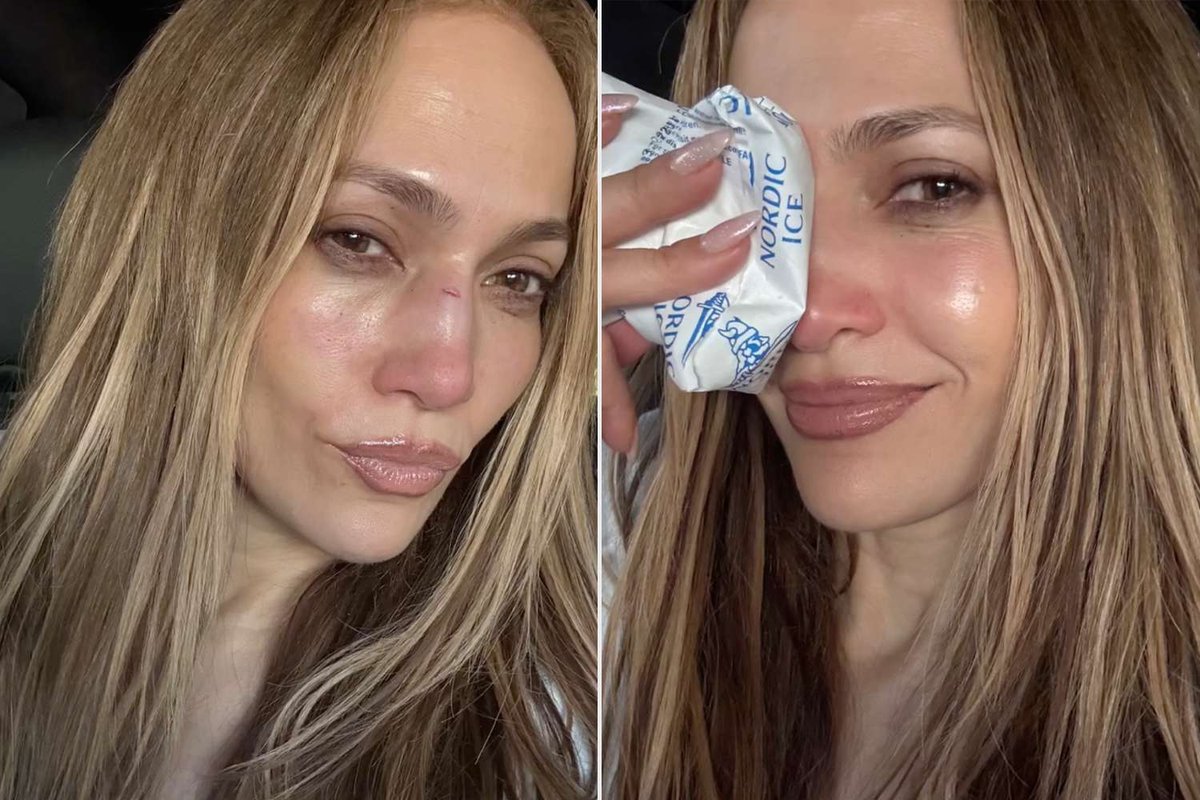 Jennifer Lopez Rehearsal Injury Sparks Empowering AMAs Comeback