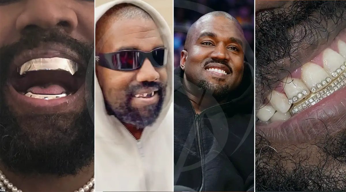 Kanye West’s Legal Symphony: The Nitrous Oxide Saga Unfolds