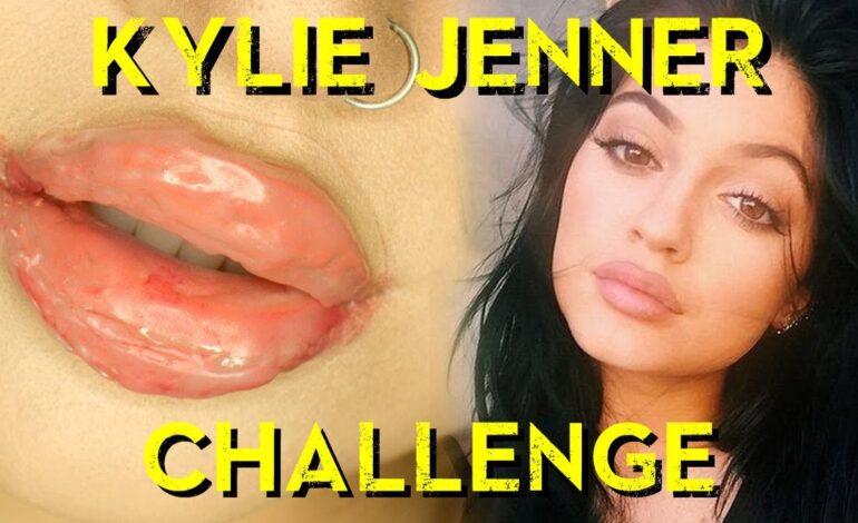 Dr. Dubrow Pleads with Kylie Jenner to Warn Teens Against Early Boob Jobs