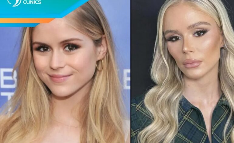 Graves’ Game Changer: Erin Moriarty’s Candid Health Reveal