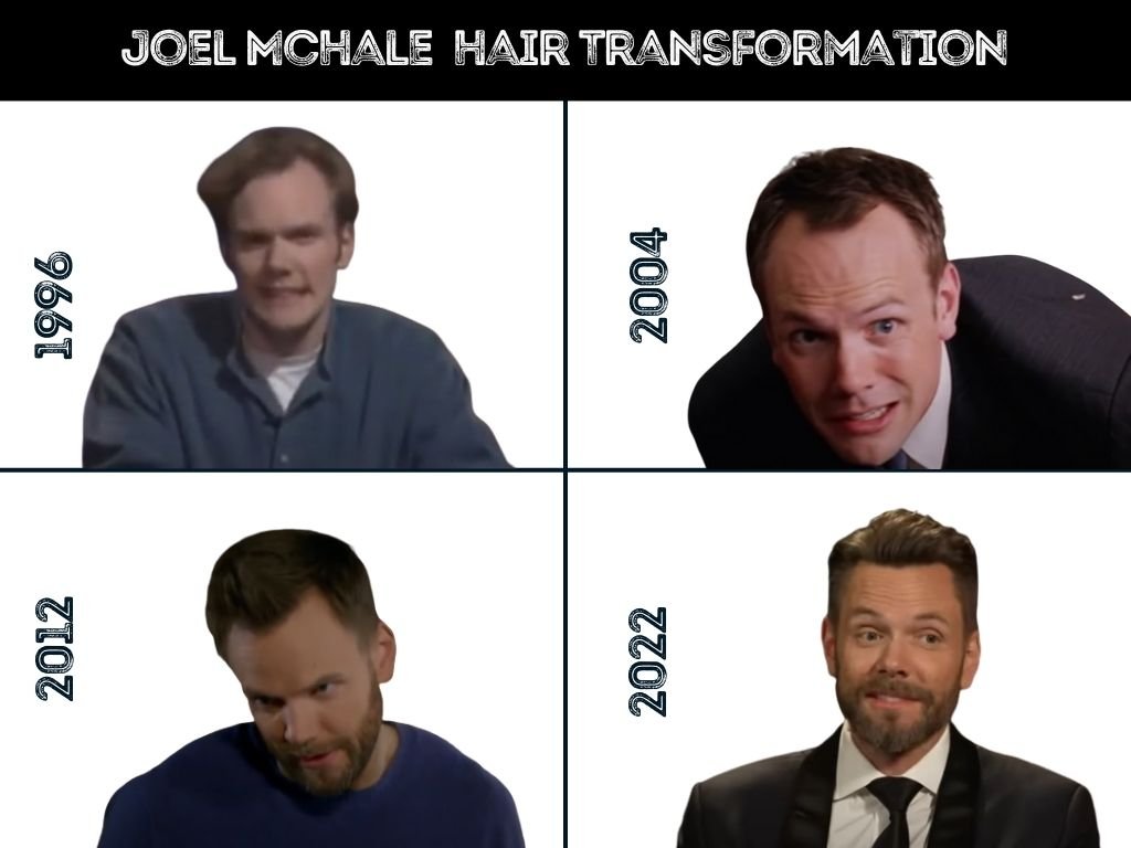 Joel McHale Opens Up on Four Hair Transplants: Pain, Price & Pro Tips