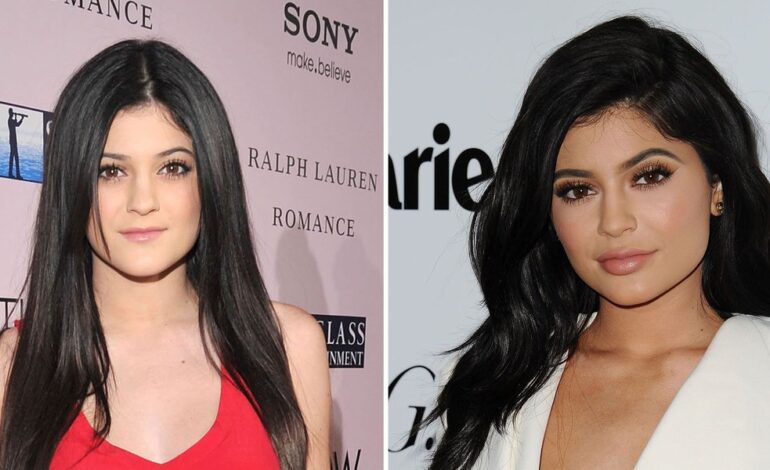 Kris Jenner Unveils Shared Surgeon for 2011 Facelift and Kylie’s Breast Augmentation
