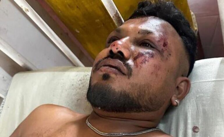Miraculous Survivor of Air India Flight AI171 Speaks Out