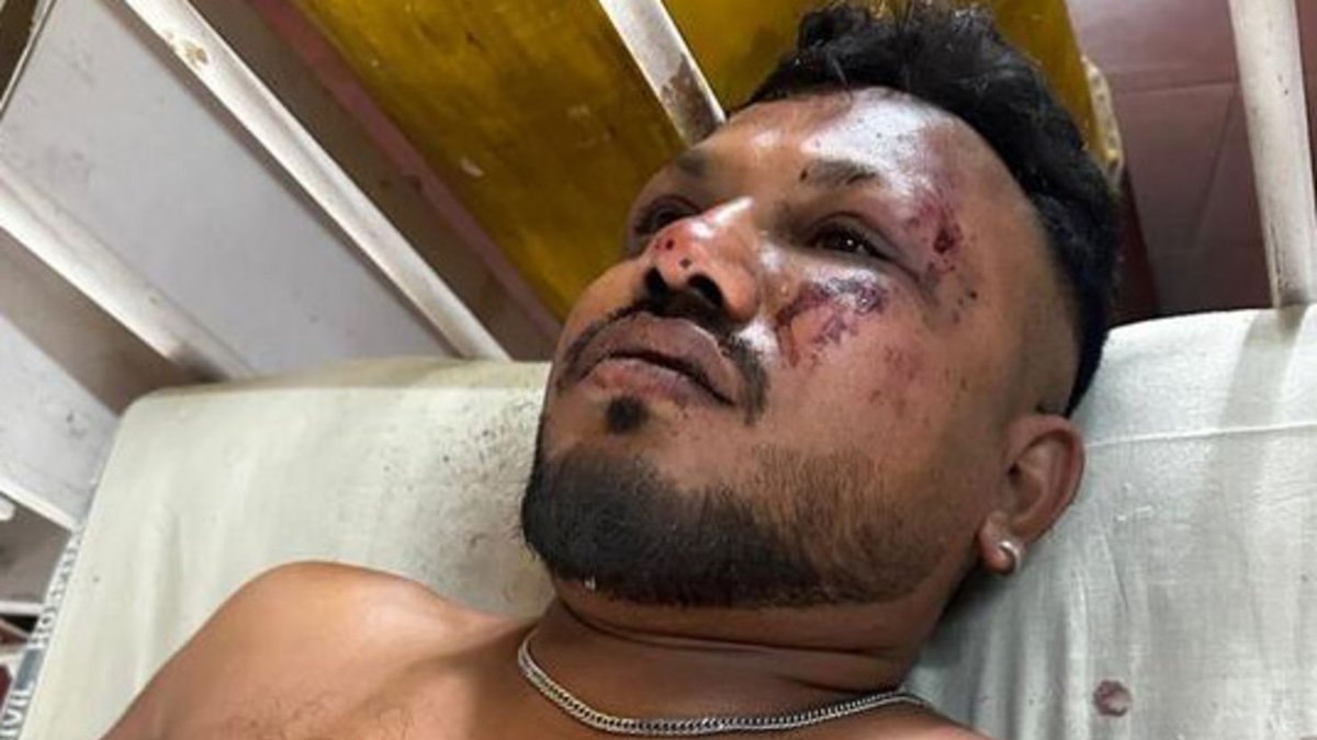 Miraculous Survivor of Air India Flight AI171 Speaks Out