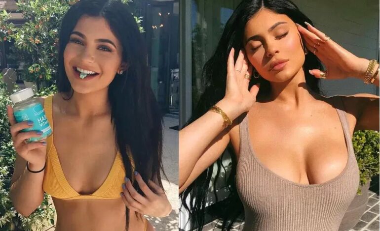 Surgeon’s Kylie Jenner–Style Boob Jobs Surge After Specs Leak