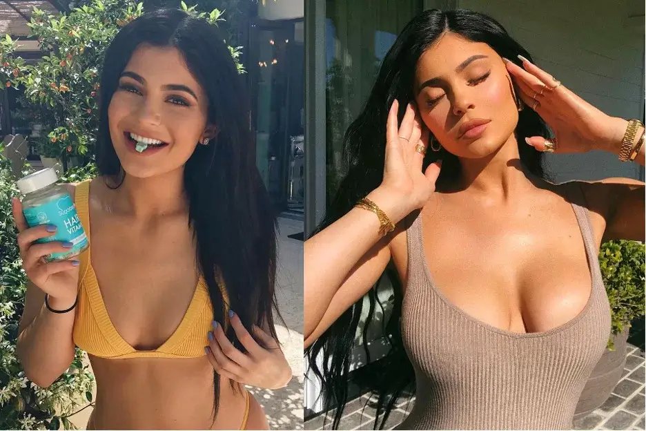 Surgeon’s Kylie Jenner–Style Boob Jobs Surge After Specs Leak