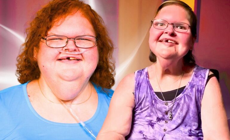 Tammy Slaton’s Jaw-Dropping Skin Removal Reveal: A New Chapter Unfolds