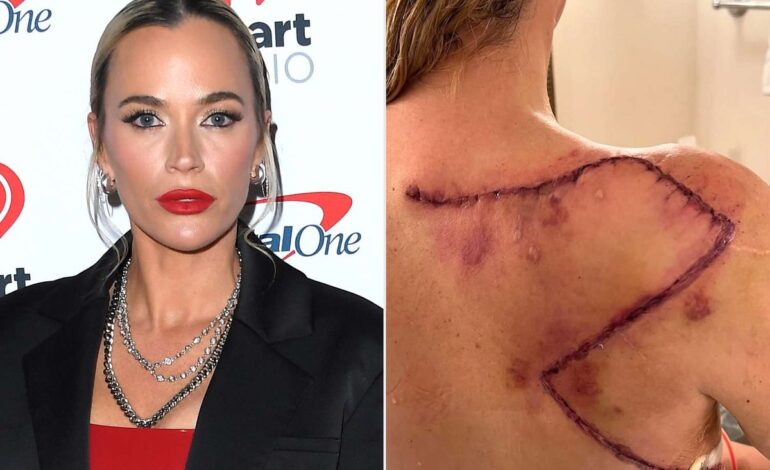 Teddi Mellencamp Fires Back at Critics: Love and Life Amid Cancer
