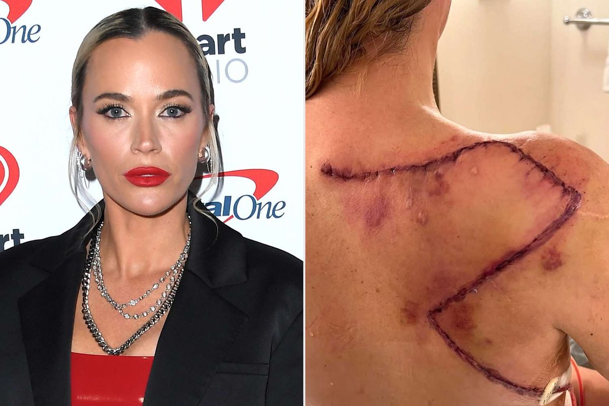 Teddi Mellencamp Fires Back at Critics: Love and Life Amid Cancer
