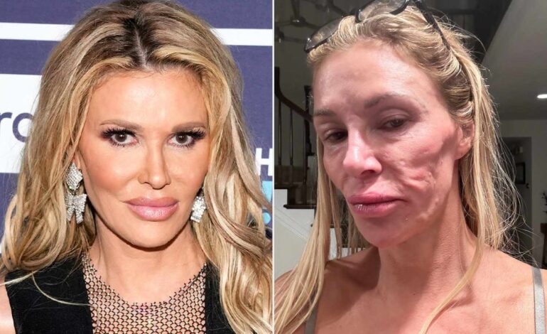 Brandi Glanville Uncovers Medical Clues to Facial Disfigurement