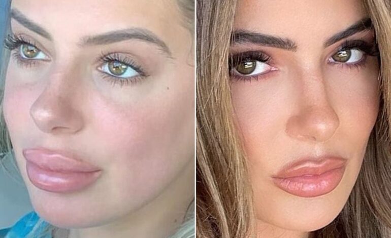 Brielle Biermann Compares Fillers to Diet Coke Habit in Candid Confession