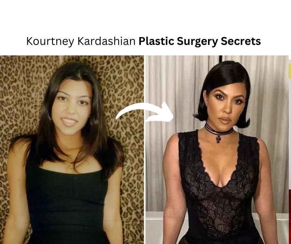 Kardashian-Jenners Reveal Their Plastic Surgery Playbook
