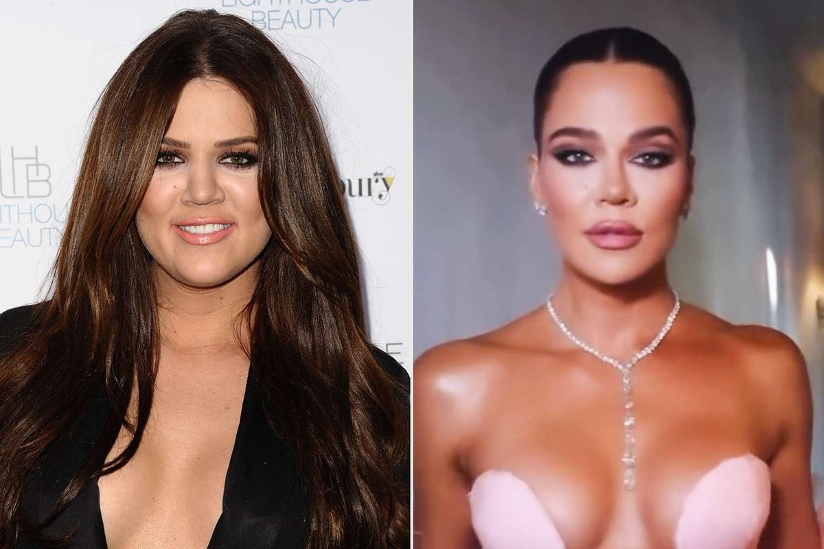 Khloe Kardashian Embraces Authentic Selfies and Ditches Photo Editing