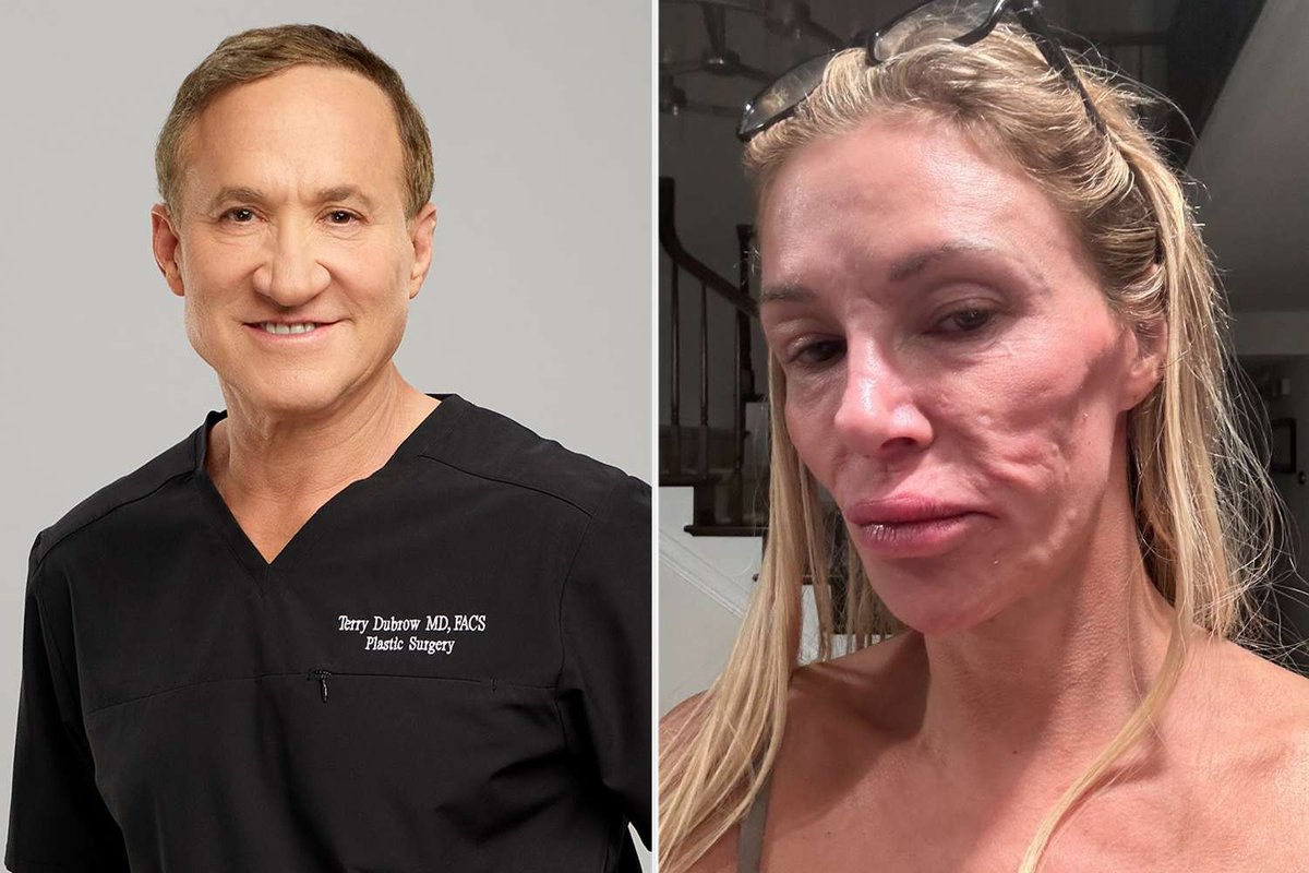 Brandi Glanville Reveals Cause of Facial Damage and Flaunts Recovered Look After Six-Figure Hunt