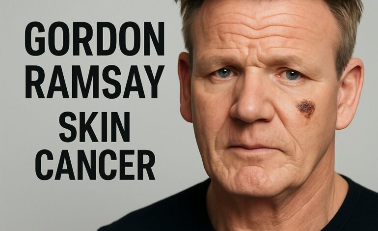 Gordon Ramsay Shares Skin Cancer Surgery Scar, Thanks Fast-Acting Doctors and Urges Sunscreen