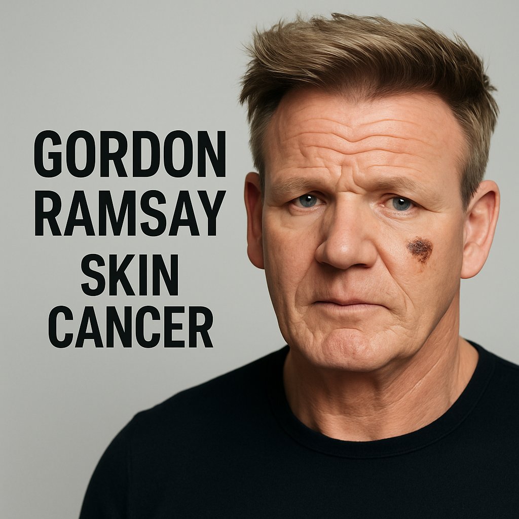 Gordon Ramsay Shares Skin Cancer Surgery Scar, Thanks Fast-Acting Doctors and Urges Sunscreen