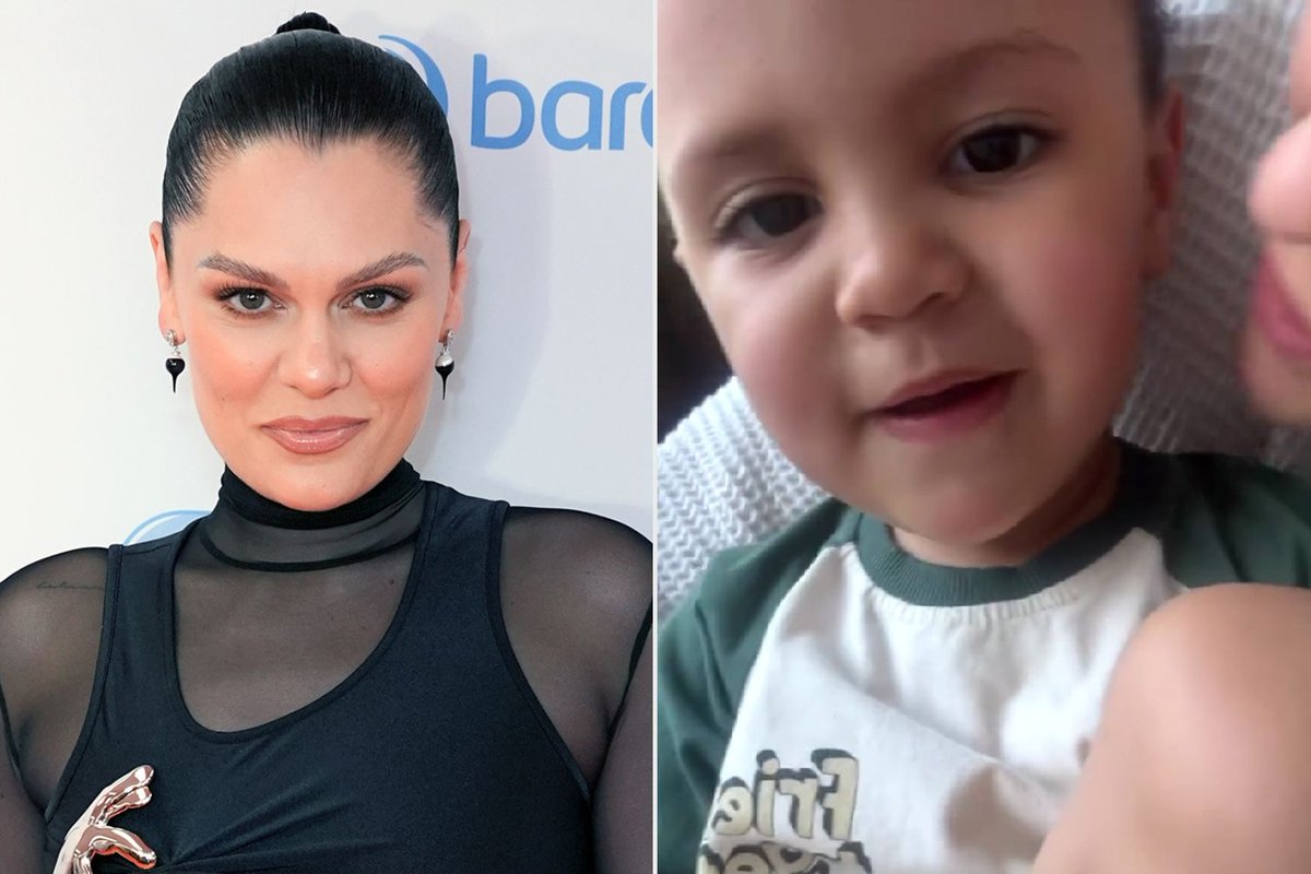 Jessie J Says Hair Is Falling Out “Like Crazy” After Mastectomy — Balancing Recovery, Toddler and New Music