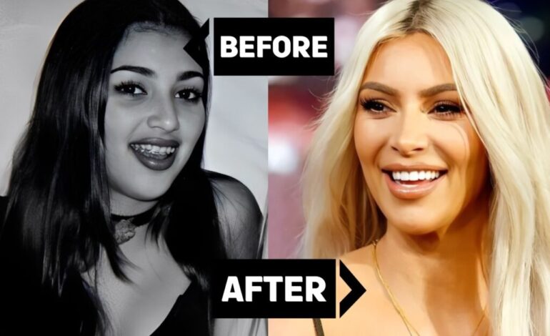 Kim Kardashian Posts Close-Up of Saint West’s Bloody Front Tooth