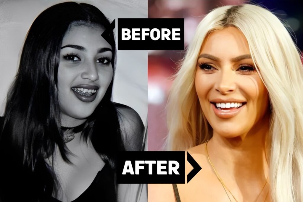 Kim Kardashian Posts Close-Up of Saint West’s Bloody Front Tooth