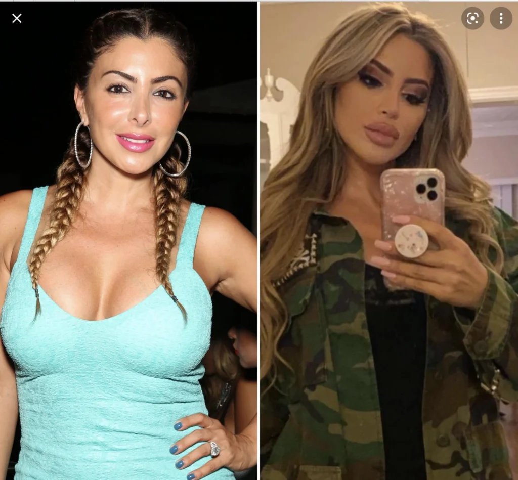 Larsa Pippen Claps Back: Allergic Reaction, Not “Overfilled” Cosmetic Work