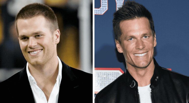 Tom Brady’s Epic Glow-Up: Good Genes or Top Docs?