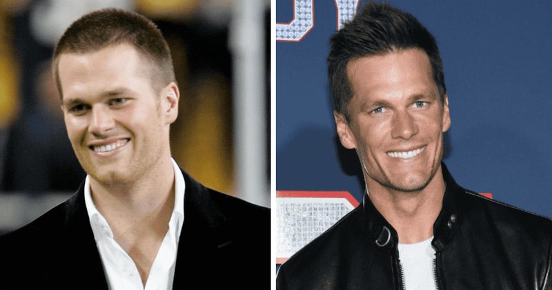 Tom Brady’s Epic Glow-Up: Good Genes or Top Docs?
