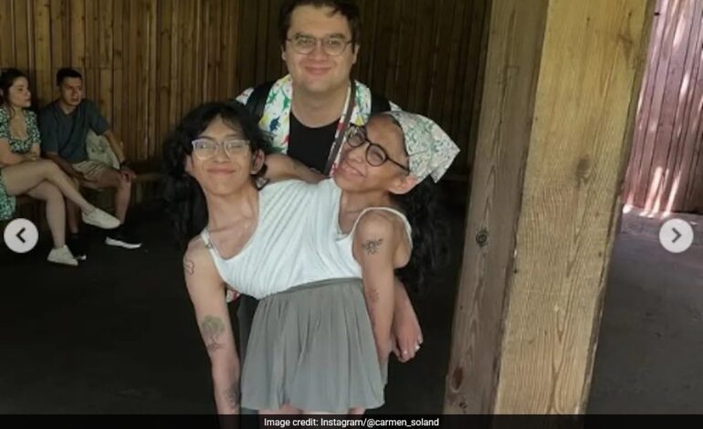 Conjoined Twin Carmen Andrade Slams Critics Over Sex Life: Private Boundaries Go Viral