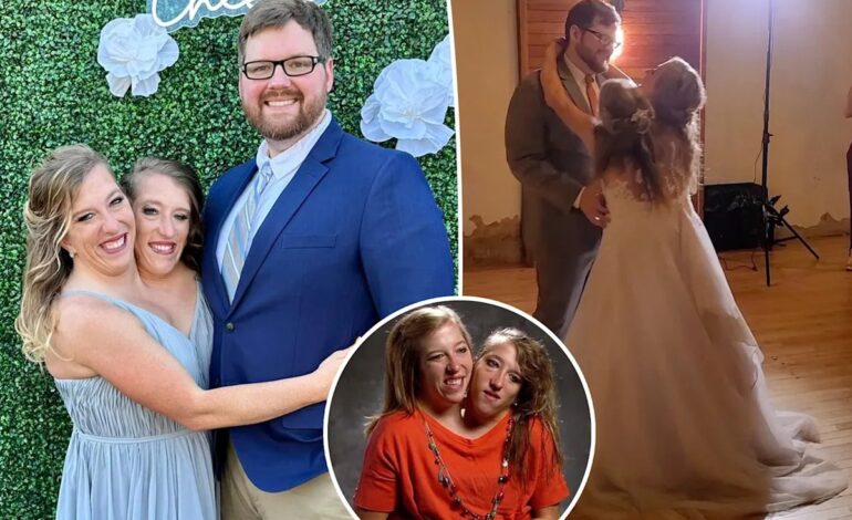 Conjoined Twins’ Husband Shuts Down Fake TikTok Account Rumors