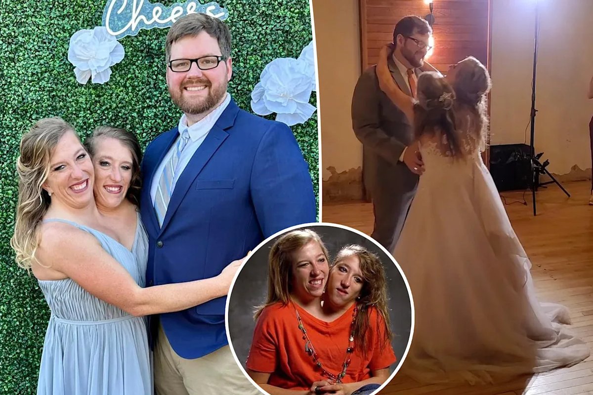 Conjoined Twins’ Husband Shuts Down Fake TikTok Account Rumors