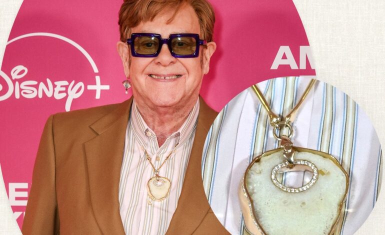 Elton John Turns Kneecaps Into Timeless Jewelry: The Sparkling, Surprising Art of Goodbye to Pain