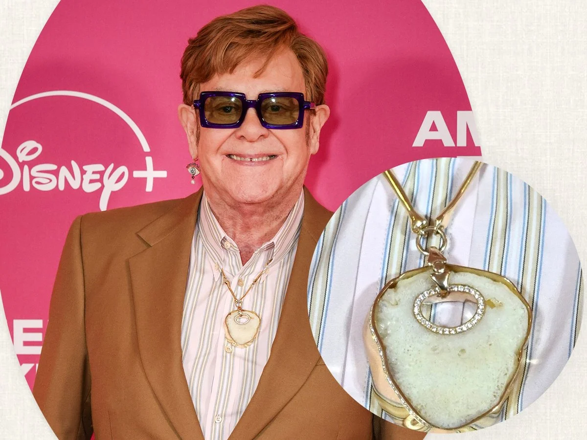 Elton John Turns Kneecaps Into Timeless Jewelry: The Sparkling, Surprising Art of Goodbye to Pain